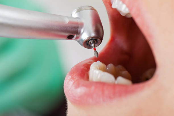 Best Emergency Cosmetic Dentistry in Parsons, WV